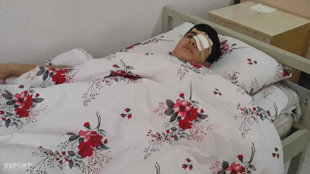 Ov tüfəngi ilə məktəblini gözündən yaraladılar   - Abşeronda  -  FOTO